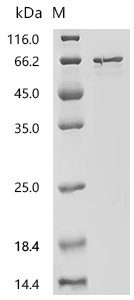 Human Pyruvate dehydrogenase E1 component subunit alpha, somatic form, mitochondrial (PDHA1), partial Recombinant Protein, N-His-SUMO, Homo sapiens (Human), E.coli, N-terminal 6xHis-SUMO-tagged, 58.2 kDa, purity >≥ 90% as determined by SDS-PAGE.