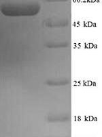 Mouse Protein disulfide-isomerase A2 (Pdia2) Recombinant Protein, N-His - BioCrest Sci