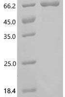 Human Melanoma antigen preferentially expressed in tumors (PRAME) Recombinant Protein - BioCrest Sci