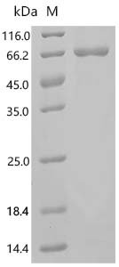 Human Melanoma antigen preferentially expressed in tumors (PRAME) Recombinant Protein, Homo sapiens (Human), E.coli, C-terminal 6xHis-tagged, 64.8 kDa, purity >≥ 85% as determined by SDS-PAGE.
