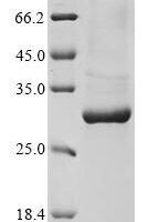 Rattus norvegicus COMM domain-containing protein 5 (Commd5) Recombinant Protein - BioCrest Sci
