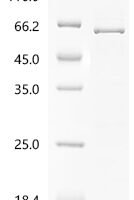 Human Cholesteryl ester transfer protein (CETP) Recombinant Protein, C-His - BioCrest Sci