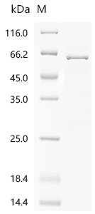 Human Cholesteryl ester transfer protein (CETP) Recombinant Protein, C-His, Homo sapiens (Human), E.coli, C-terminal 6xHis-tagged, 60.0 kDa, purity >≥ 85% as determined by SDS-PAGE.