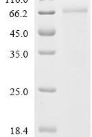 Human Zinc finger Y-chromosomal protein (ZFY), partial Recombinant Protein, C-His, aa 1–409, Mammalian cell - BioCrest Sci