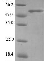 Human Four and a half LIM domains protein 3 (FHL3) Recombinant Protein - BioCrest Sci