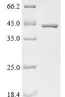 Human Transcriptional enhancer factor TEF-5 (TEAD3), partial Recombinant Protein, C-His - BioCrest Sci
