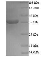 Zaire ebolavirus Transcriptional activator VP30 (VP30) Recombinant Protein, N-His, aa 1–288, Yeast - BioCrest Sci