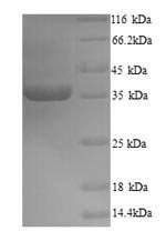 Zaire ebolavirus Transcriptional activator VP30 (VP30) Recombinant Protein, N-His, aa 1–288, Yeast, Zaire ebolavirus (strain Kikwit-95) (ZEBOV) (Zaire Ebola virus), Yeast, N-terminal 6xHis-tagged, 34.5 kDa, purity >≥ 90% as determined by SDS-PAGE.