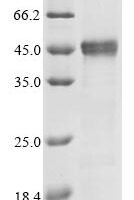 Dermatophagoides pteronyssinus Mite allergen Der p 3 (DERP3) Recombinant Protein, N-His-SUMO - BioCrest Sci