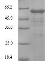Human PDZ and LIM domain protein 1 (PDLIM1) Recombinant Protein - BioCrest Sci
