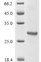 Mouse Erythropoietin receptor (Epor), partial Recombinant Protein - BioCrest Sci