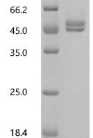 Chicken Ovalbumin (SERPINB14) Recombinant Protein, C-His, aa 2–386, Yeast - BioCrest Sci