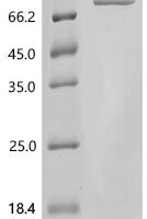 Human Guanylate-binding protein 3 (GBP3) Recombinant Protein - BioCrest Sci