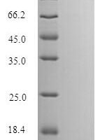 Human Putative protein SFTA3 (SFTA3) Recombinant Protein, N-His-Myc - BioCrest Sci