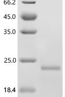 Mouse Sushi, von Willebrand factor type A, EGF and pentraxin domain-containing protein 1 (Svep1), partial Recombinant Protein, N-10His/C-Myc - BioCrest Sci