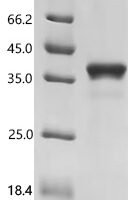Mouse Tumor necrosis factor receptor superfamily member 16 (Ngfr), partial Recombinant Protein, C-hFc1 - BioCrest Sci