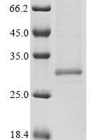Tetronarce californica Acetylcholine receptor subunit alpha (CHRNA1), partial Recombinant Protein, N-10His - BioCrest Sci