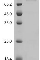 Human Mucin-16 (MUC16), partial, Biotinylated Recombinant Protein - BioCrest Sci