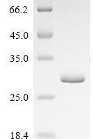 Drosophila melanogaster Maternal protein pumilio (pum), partial Recombinant Protein - BioCrest Sci