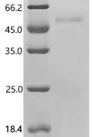 Human Scavenger receptor class F member 2 (SCARF2), partial Recombinant Protein - BioCrest Sci