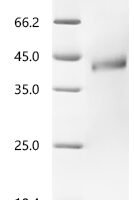 Human R-spondin-1 (RSPO1) Recombinant Protein - BioCrest Sci