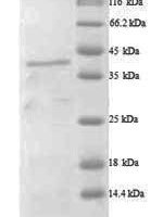 Human A disintegrin and metalloproteinase with thrombospondin motifs 7 (ADAMTS7), partial Recombinant Protein - BioCrest Sci