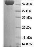 Human Mannan-binding lectin serine protease 1 (MASP1) Recombinant Protein, N-His, aa 20–699, Yeast - BioCrest Sci