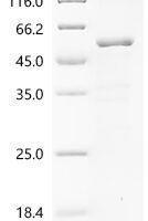 Newcastle disease virus Fusion glycoprotein F0 (F), partial Recombinant Protein, N-10His/C-Myc, aa 32–500, strain Chicken/United States/LaSota/46 - BioCrest Sci