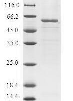Human Trans-1,2-dihydrobenzene-1,2-diol dehydrogenase (DHDH) Recombinant Protein - BioCrest Sci