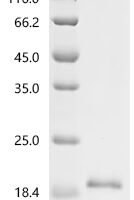 Human Zinc finger and BTB domain-containing protein 10 (ZBTB10), partial Recombinant Protein - BioCrest Sci