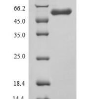 Rat Angiopoietin-1 (Angpt1) Recombinant Protein, N-His - BioCrest Sci