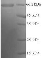 Human Atrial natriuretic peptide receptor 2 (NPR2), partial Recombinant Protein, N-His-SUMO - BioCrest Sci