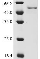 Human coronavirus OC43 Nucleoprotein (N) Recombinant Protein, N-10His/C-Myc, aa 1–448, Baculovirus - BioCrest Sci