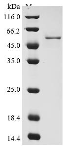 Human coronavirus OC43 Nucleoprotein (N) Recombinant Protein, N-10His/C-Myc, aa 1–448, Baculovirus, Human coronavirus OC43 (HCoV-OC43), Baculovirus, N-terminal 10xHis-tagged and C-terminal Myc-tagged, 53.2 kDa, purity >≥ 90% as determined by SDS-PAGE.