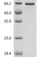 Human Protein HEXIM1 (HEXIM1) Recombinant Protein, C-His - BioCrest Sci