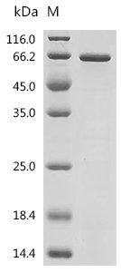 Human Protein HEXIM1 (HEXIM1) Recombinant Protein, C-His, Homo sapiens (Human), E.coli, C-terminal 6xHis-tagged, 47.5 kDa, purity >≥ 85% as determined by SDS-PAGE.