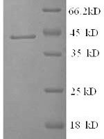 Human Corticosteroid-binding globulin (SERPINA6) Recombinant Protein - BioCrest Sci