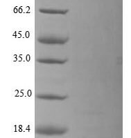 Vaccinia virus Truncated plaque-size/host range protein (PS/HR) Recombinant Protein, N-His - BioCrest Sci