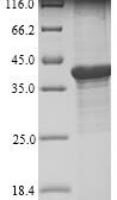 Bartonella henselae Lipoyl synthase (lipA) Recombinant Protein, N-10His - BioCrest Sci
