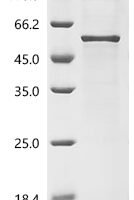 Staphylococcus aureus Immunoglobulin-binding protein sbi (sbi) Recombinant Protein, C-His - BioCrest Sci