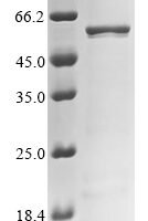 Human Retinoid isomerohydrolase (RPE65) Recombinant Protein - BioCrest Sci