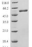 Human SAP30-binding protein (SAP30BP) Recombinant Protein - BioCrest Sci
