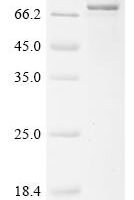 Human E3 ubiquitin-protein ligase XIAP (XIAP) (1-1:M→MM) Recombinant Protein - BioCrest Sci