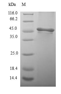 Human Proteasome subunit beta type-3 (PSMB3) Recombinant Protein, Homo sapiens (Human), E.coli, N-terminal GST-tagged, 49.8 kDa, purity >≥ 90% as determined by SDS-PAGE.