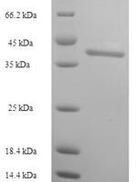 Human Intestine-specific homeobox (ISX) Recombinant Protein - BioCrest Sci