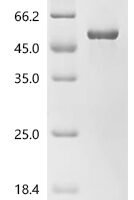 Human N-acylglucosamine 2-epimerase (RENBP) Recombinant Protein - BioCrest Sci