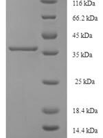 Human Cytoglobin (CYGB) Recombinant Protein - BioCrest Sci