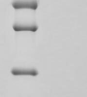 Human Aryl hydrocarbon receptor nuclear translocator (ARNT), partial Recombinant Protein - BioCrest Sci
