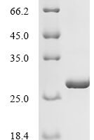 Human Neutrophil elastase (ELANE) Recombinant Protein, C-His - BioCrest Sci