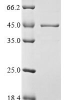 Mouse Heterogeneous nuclear ribonucleoproteins A2/B1 (Hnrnpa2b1) Recombinant Protein, N-10His - BioCrest Sci